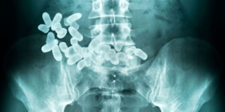 drugs smuggling capsules xray