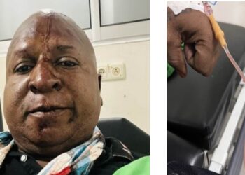 bennie web De bekende social media-persoonlijkheid Bennie Miranda is zwaar mishandeld en verwond door een groep mannen die hij heeft geïdentificeerd als ‘ABOP'ers’. De mishandeling heeft plaatsgevonden in de nacht van vrijdag op zaterdag tijdens een rouwzitting van een familielid te Sophia’s Lust. Er zijn daarbij ook schoten gelost.