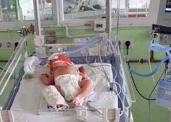 image 870x 66c499b06c52a Door gebrek aan gekwalificeerd personeel, hebben drie baby's het niet gehaald op de Neonatale Intensive Care Unit (NICU). Het Academsich Ziekenhuis Paramaribo trok begin van de week al aan de bel, echter is er nog geen oplossing over de tafel gebracht.